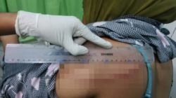 Cekcok Mulut Berujung Kekerasan, Oknum PNS di Lape Aniaya Dua IRT dengan Parang