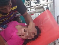 Polsek Kempo Tangani Dugaan Percobaan Bunuh Diri, Korban Masih Mendapat Perawatan Medis